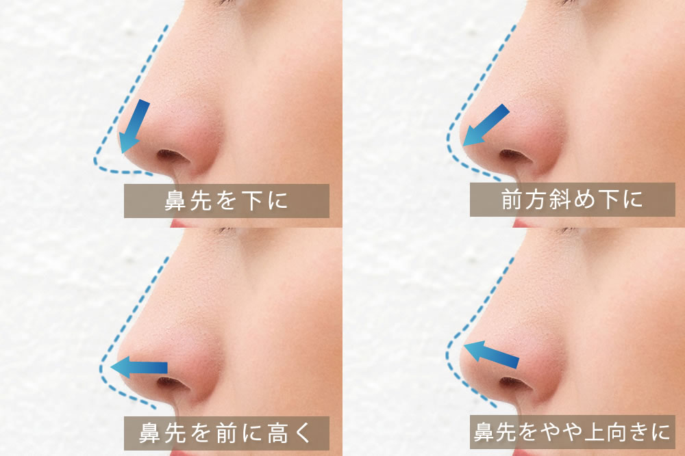 鼻先の向きを変える図解