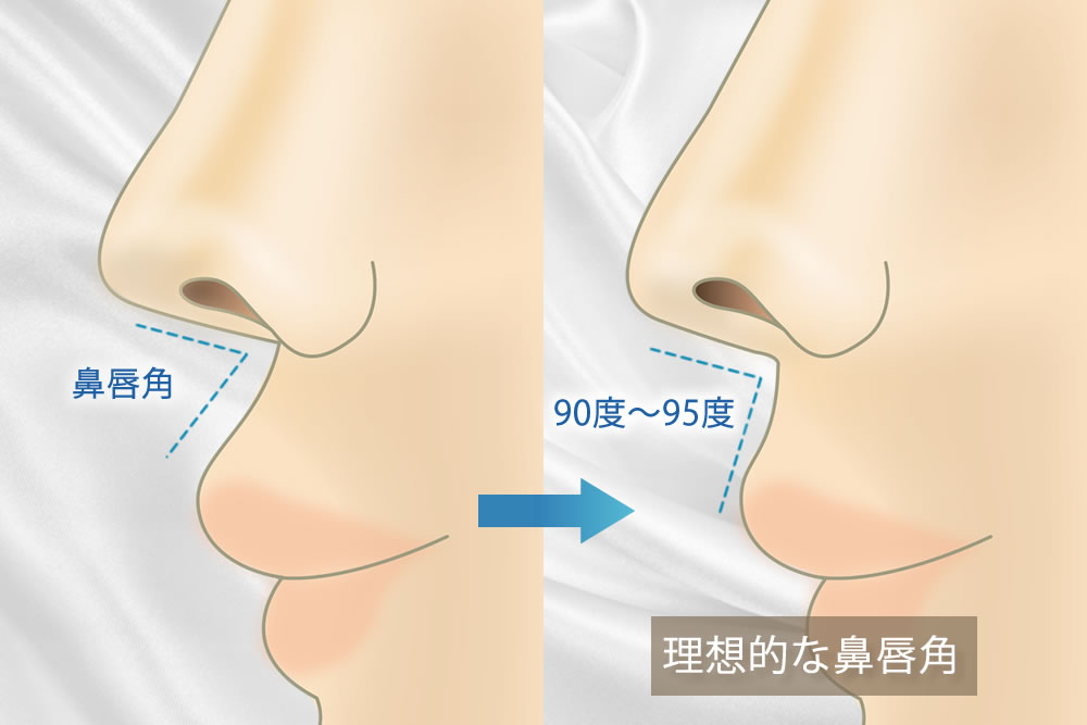 理想的な鼻唇角の図解