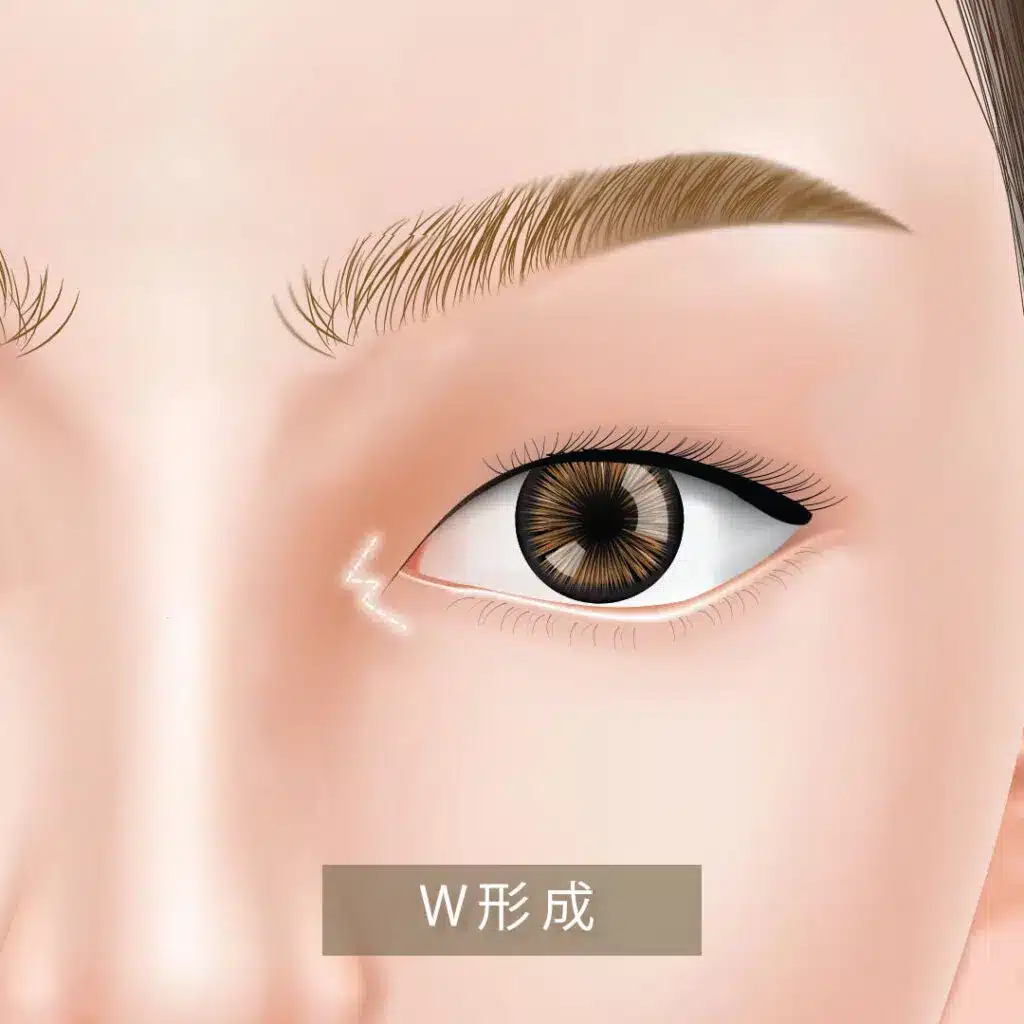 W法