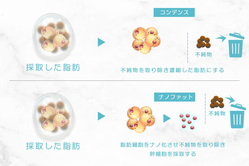 コンデンスとナノファットの違いの図解