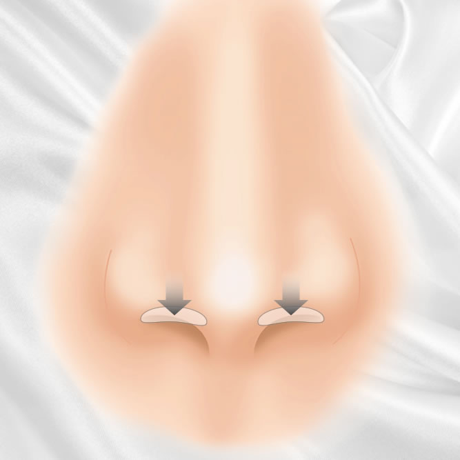 鼻孔縁下降のアイコン