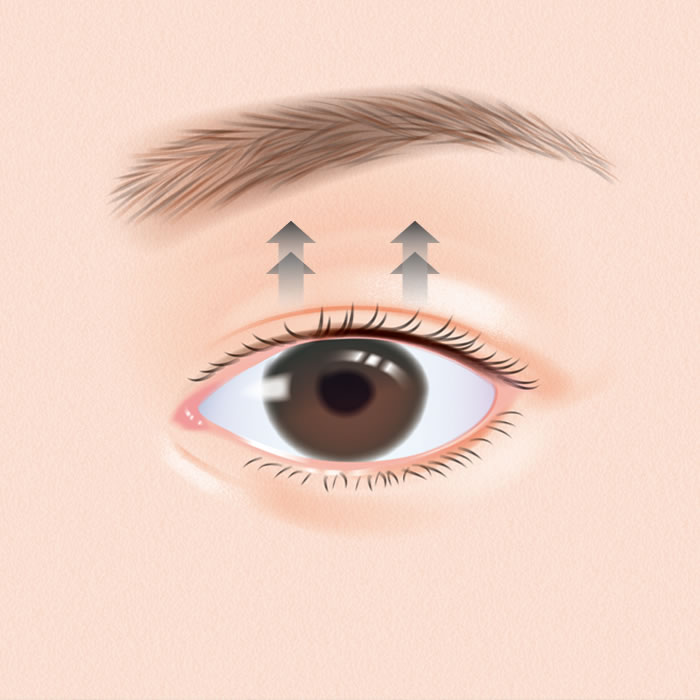 眼瞼下垂のアイコン