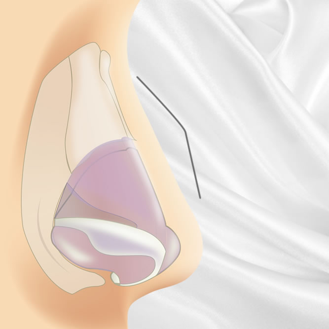 鷲鼻のイメージ