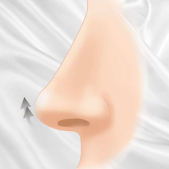 鼻柱挙上術のアイコン