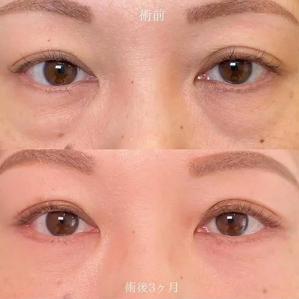 表ハムラ