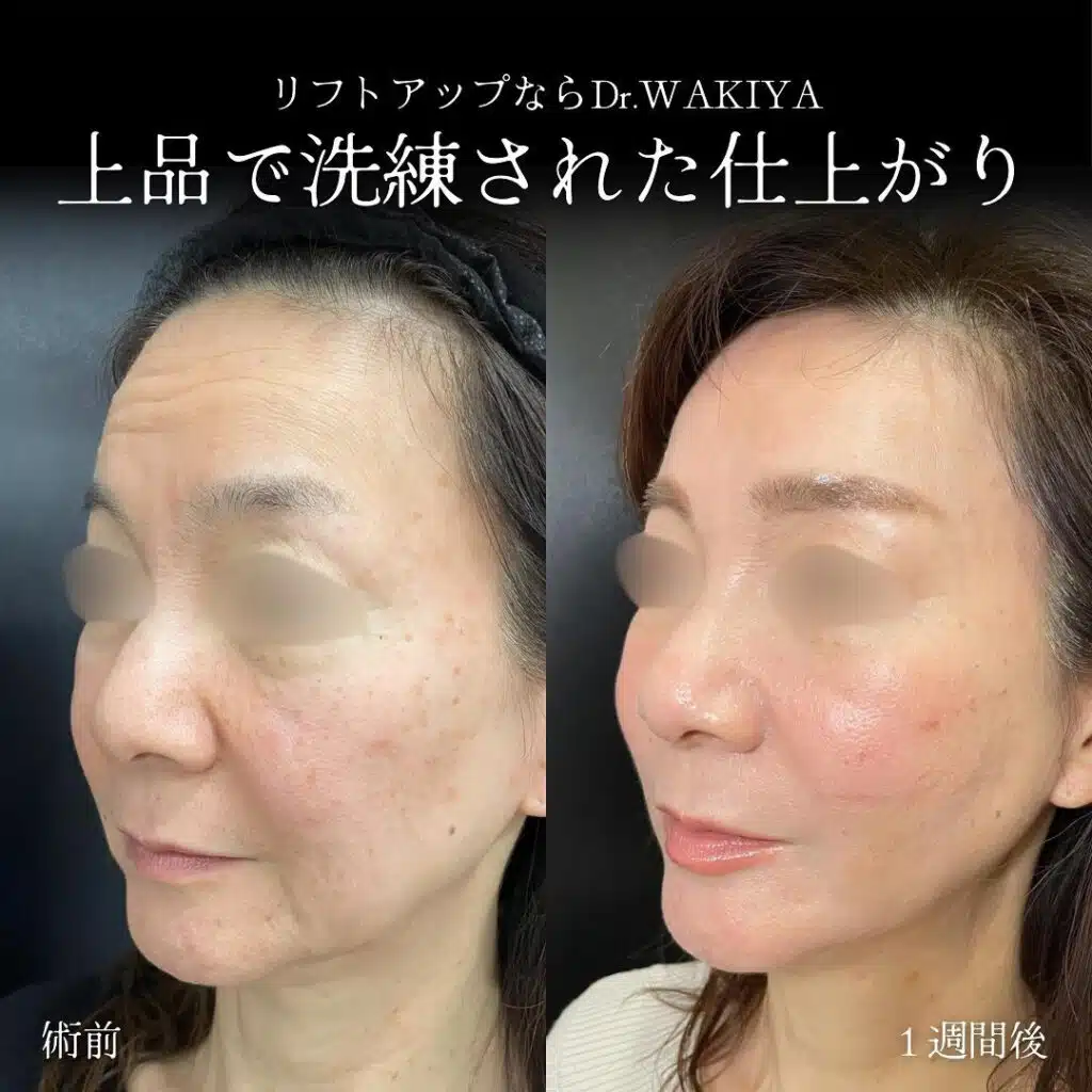 上品で洗練された仕上がり　名古屋