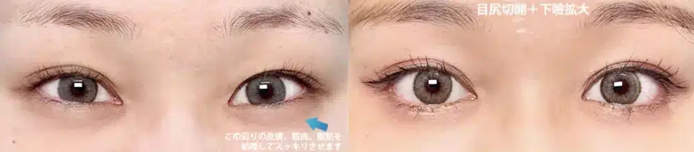 つり⽬を⾃然なアーモンド型に調整　名古屋