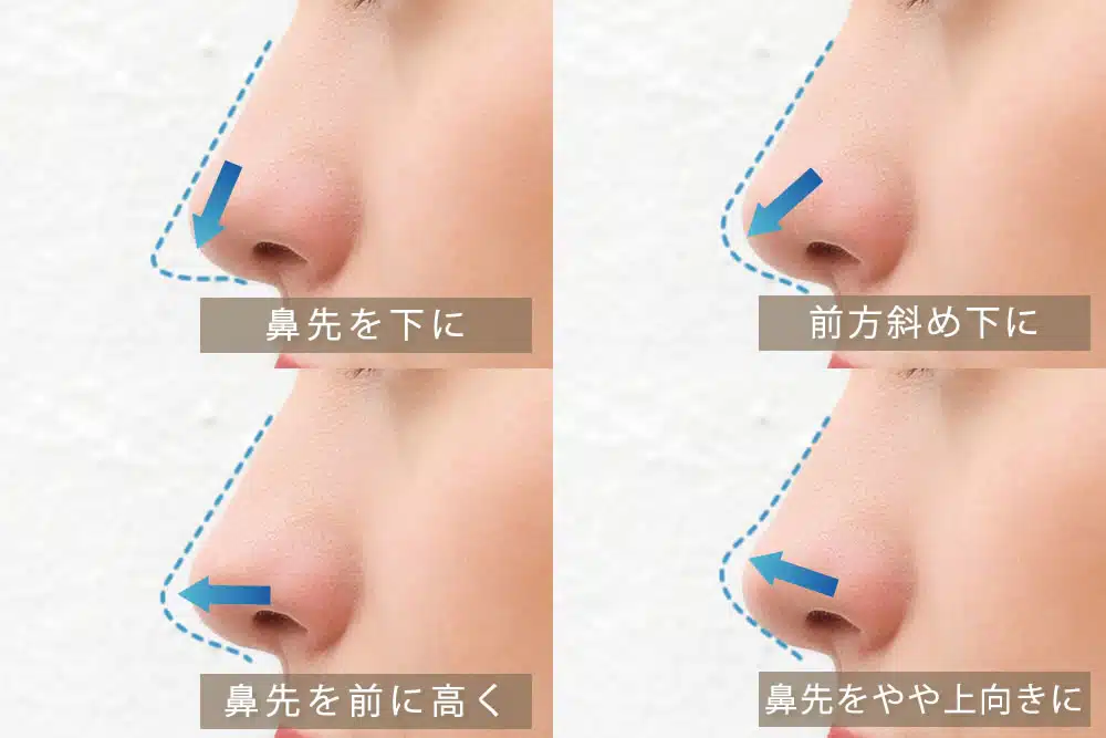 耳軟骨を鼻に挿入するデザイン 名古屋