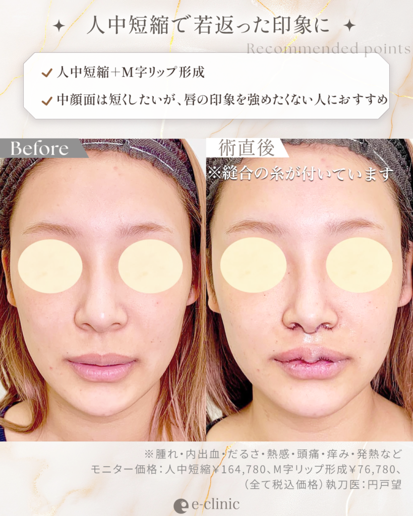 人中短縮②