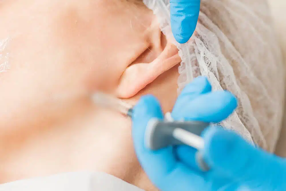 エラボトックス　名古屋