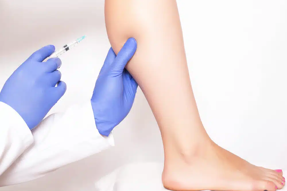 ふくらはぎボトックス　名古屋