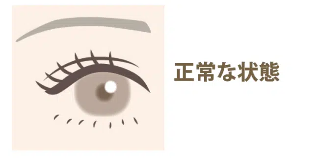 正常な目　名古屋