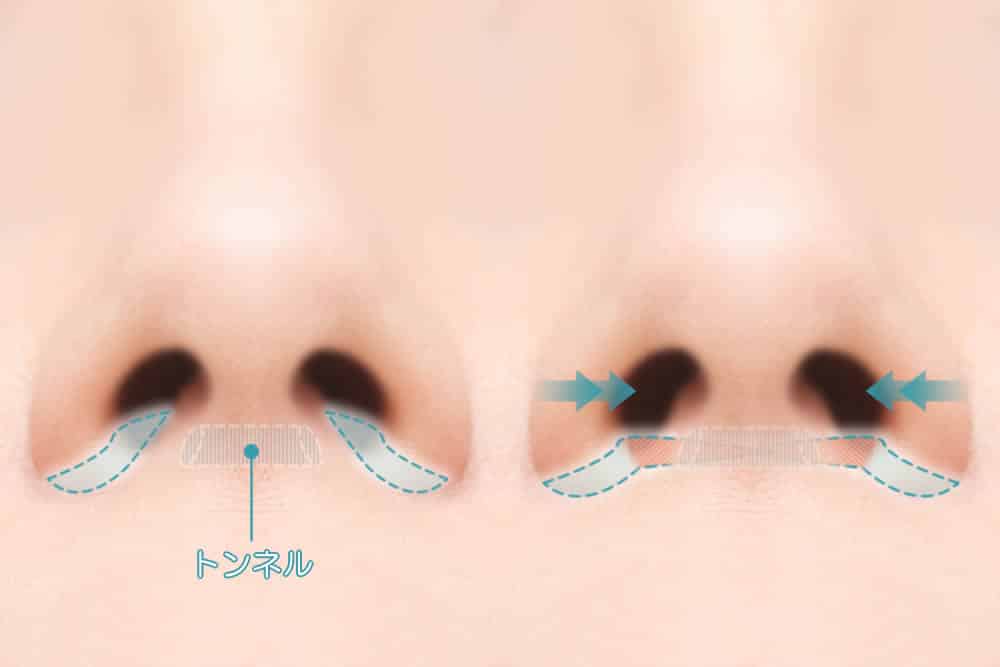 FRAP法のイメージ