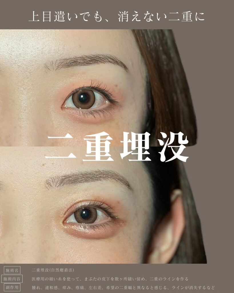 自然癒着法の症例写真 (4)