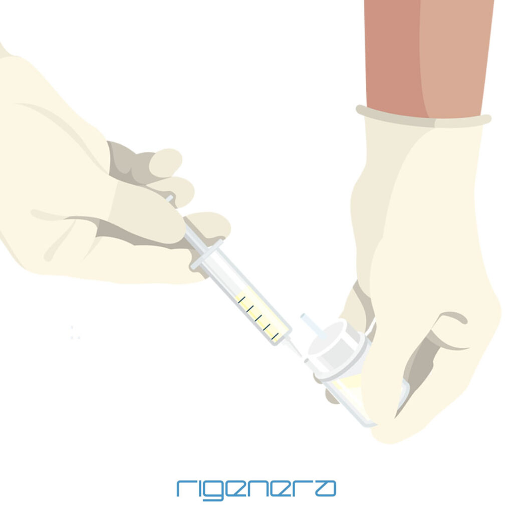 シリンジに移し替えているところのイラスト