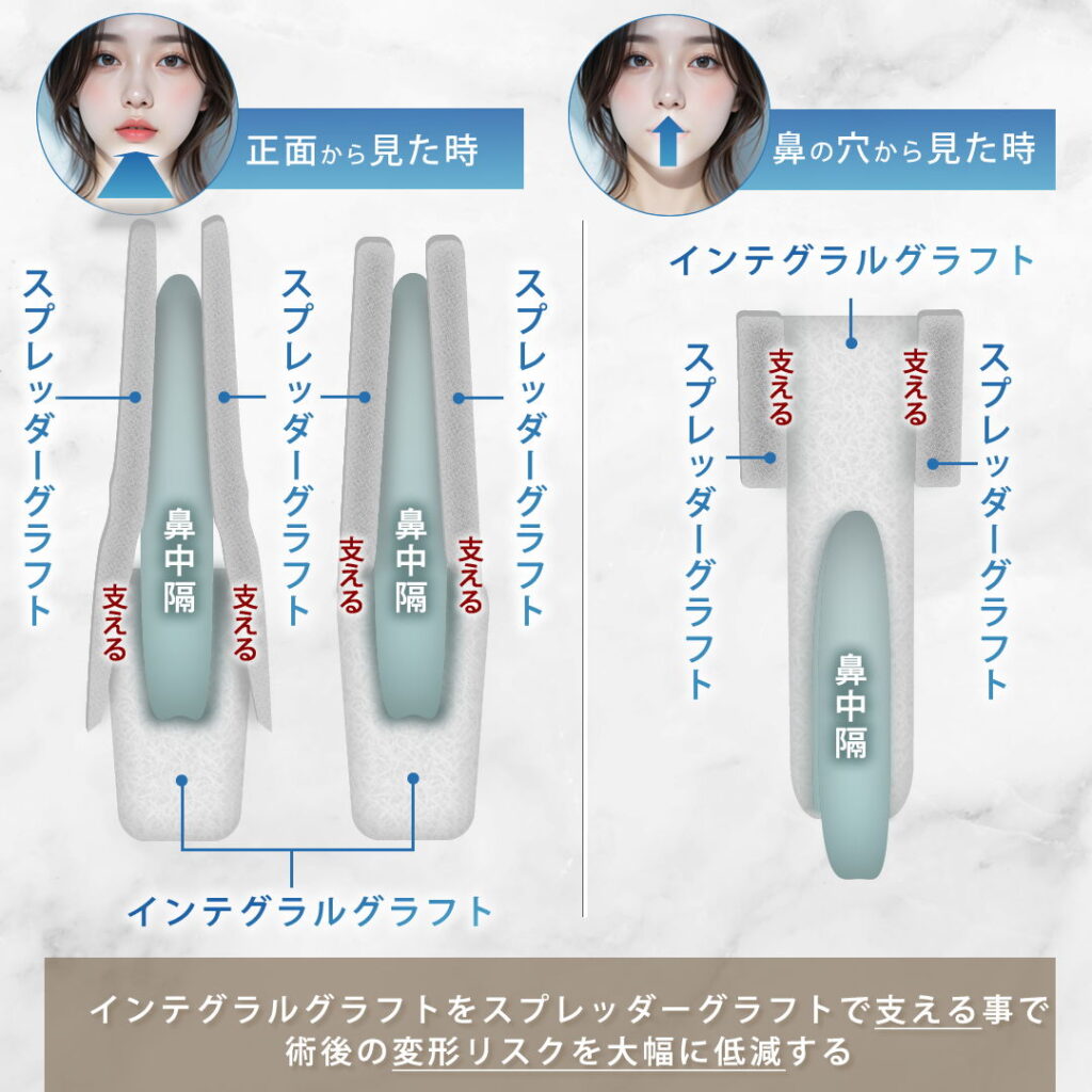 スプレッダークラフトとインテグラルクラフトの図解