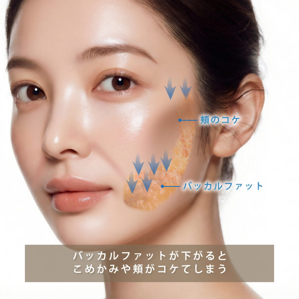 バッカルファットの下垂によりこめかみと頬がコケてしまう図解