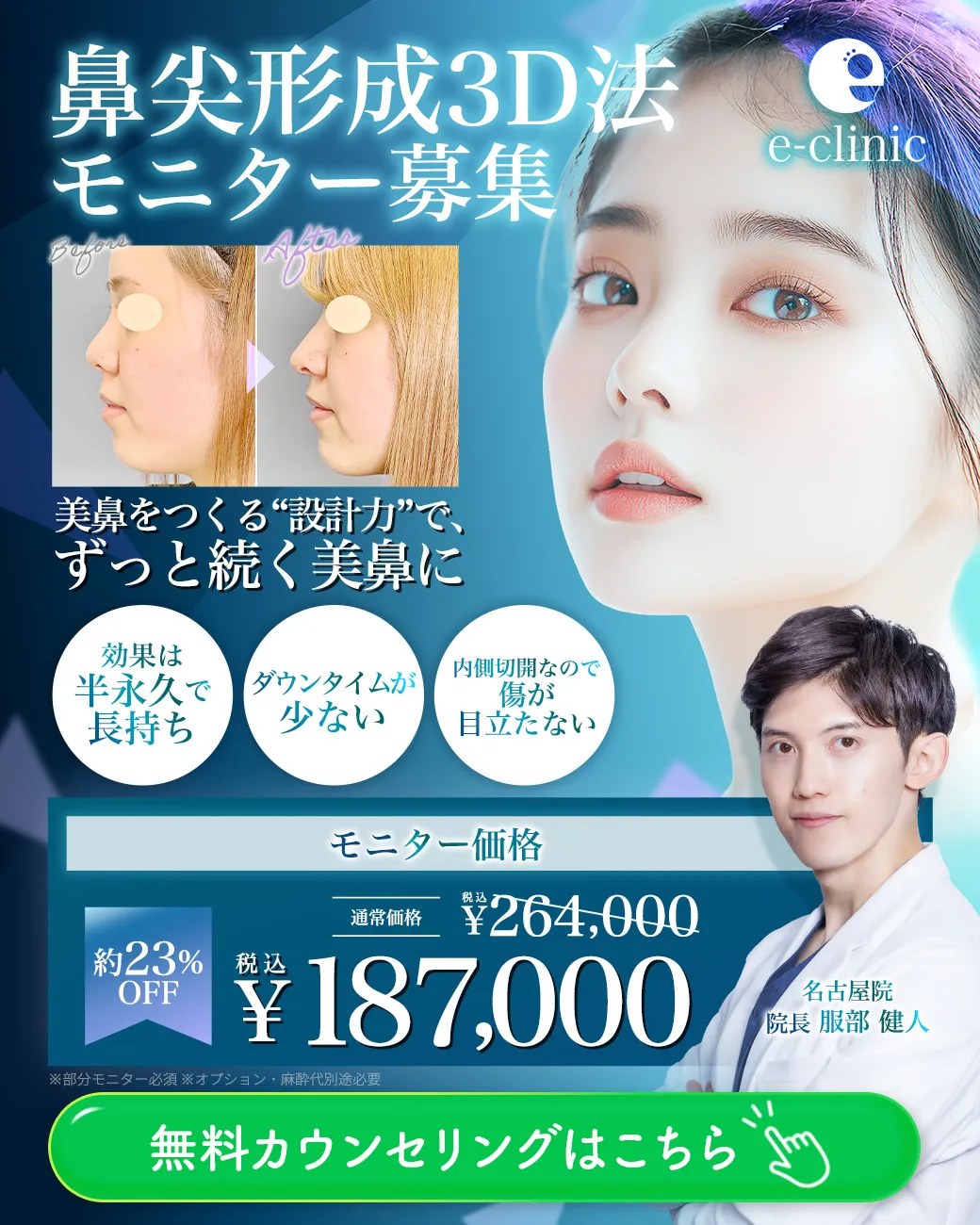 服部健人医師の鼻尖形成3D法キャンペーンバナー