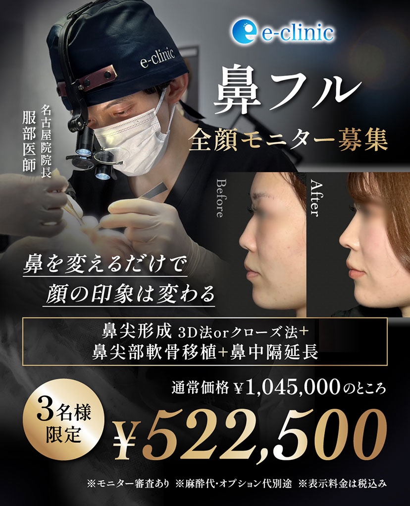 服部健人医師の鼻フルモニターキャンペーンバナー