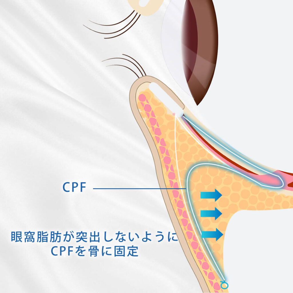 セプタルリセットをした女性のイメージ