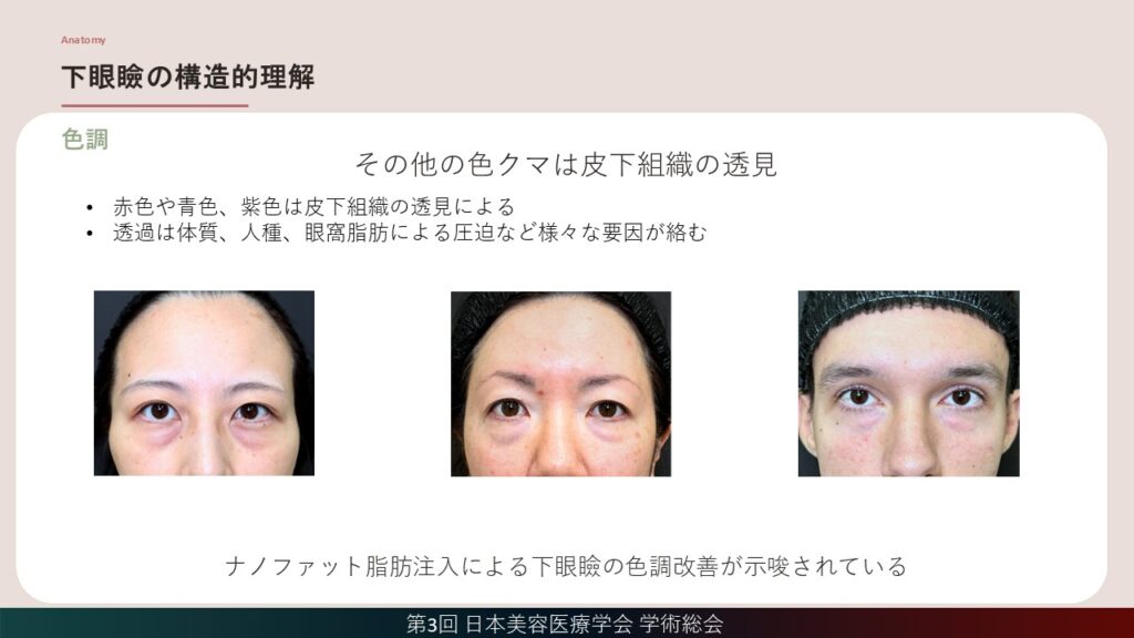 14_下眼瞼の構造的理解(色調)