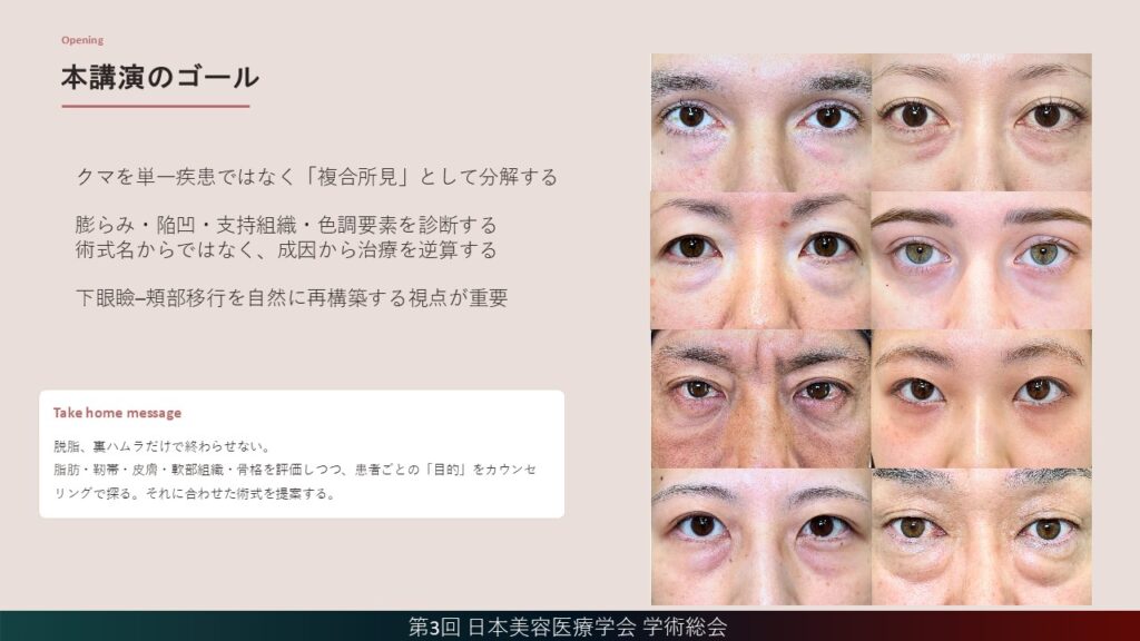 1_クマを単一疾患ではなく「複合所見」として分解する